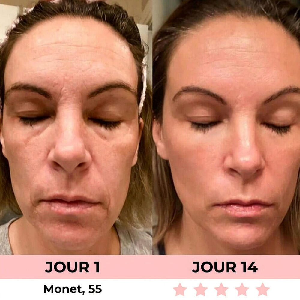 Avant et après 3