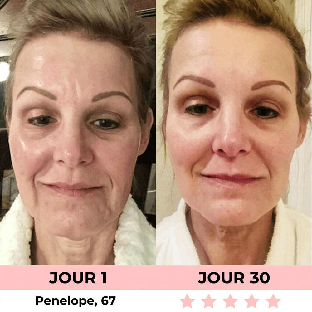 Avant et après 2