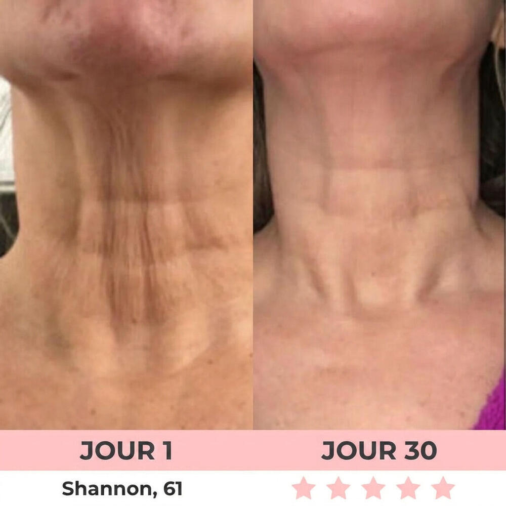 Avant et après 4