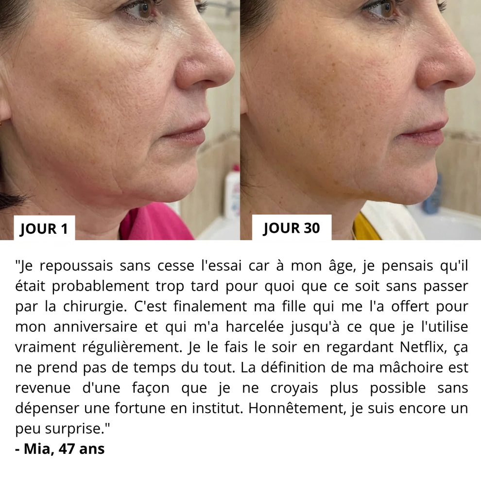Avant / après bajoues